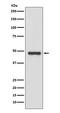 PLAU antibody, M04352, Boster Biological Technology, Western Blot image 
