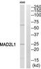 HsMAD2 antibody, TA311990, Origene, Western Blot image 