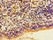 Histone Cluster 1 H1 Family Member E antibody, LS-C670373, Lifespan Biosciences, Immunohistochemistry paraffin image 
