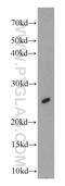 LOR antibody, 55439-1-AP, Proteintech Group, Western Blot image 