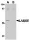 Ceramide Synthase 5 antibody, A08612, Boster Biological Technology, Western Blot image 
