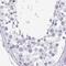 Sentan, Cilia Apical Structure Protein antibody, PA5-63565, Invitrogen Antibodies, Immunohistochemistry paraffin image 