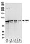 Fragile X mental retardation syndrome-related protein 2 antibody, A303-893A, Bethyl Labs, Western Blot image 