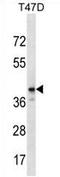 Zinc Finger Protein 124 antibody, AP54669PU-N, Origene, Western Blot image 