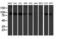 Kinesin-like protein KIF2C antibody, M03202, Boster Biological Technology, Western Blot image 
