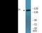 Structural Maintenance Of Chromosomes 1A antibody, EKC2510, Boster Biological Technology, Western Blot image 