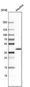 Keratin 20 antibody, NBP1-85599, Novus Biologicals, Western Blot image 