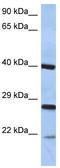 Cell Death Inducing DFFA Like Effector B antibody, TA330407, Origene, Western Blot image 