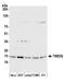 Transmembrane P24 Trafficking Protein 2 antibody, A305-466A, Bethyl Labs, Western Blot image 