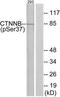 Catenin Beta 1 antibody, TA313142, Origene, Western Blot image 