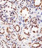 Peroxisome proliferator-activated receptor alpha antibody, M00600, Boster Biological Technology, Immunohistochemistry paraffin image 