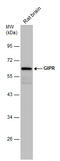 Gastric Inhibitory Polypeptide Receptor antibody, GTX129984, GeneTex, Western Blot image 