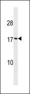 SEC11 Homolog A, Signal Peptidase Complex Subunit antibody, LS-B8769, Lifespan Biosciences, Western Blot image 