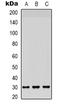 Carcinoembryonic antigen-related cell adhesion molecule 3 antibody, orb339127, Biorbyt, Western Blot image 