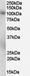 Phosphodiesterase 5A antibody, NB300-957, Novus Biologicals, Western Blot image 