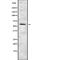 Solute carrier family 22 member 1 antibody, abx218613, Abbexa, Western Blot image 