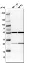 LAP2 alpha antibody, PA5-52519, Invitrogen Antibodies, Western Blot image 