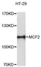 Proto-oncogene DBL antibody, A05775, Boster Biological Technology, Western Blot image 