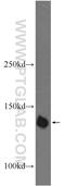 PHD finger protein 20 antibody, 22010-1-AP, Proteintech Group, Western Blot image 