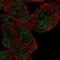 Malignant Fibrous Histiocytoma Amplified Sequence 1 antibody, NBP2-58552, Novus Biologicals, Immunocytochemistry image 