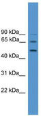 Autophagy Related 4D Cysteine Peptidase antibody, TA344179, Origene, Western Blot image 