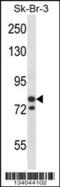 Minichromosome Maintenance Complex Component 3 antibody, 57-424, ProSci, Western Blot image 