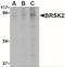 BR Serine/Threonine Kinase 2 antibody, NBP1-77281, Novus Biologicals, Western Blot image 