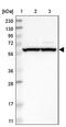Zinc Finger MYM-Type Containing 5 antibody, PA5-54273, Invitrogen Antibodies, Western Blot image 