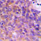 Potassium Voltage-Gated Channel Subfamily A Regulatory Beta Subunit 3 antibody, LS-C353145, Lifespan Biosciences, Immunohistochemistry paraffin image 