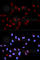 STAT3 antibody, AP0070, ABclonal Technology, Immunofluorescence image 