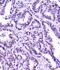 Structural Maintenance Of Chromosomes 3 antibody, M01930-1, Boster Biological Technology, Immunohistochemistry paraffin image 
