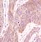 Acetyl-CoA Carboxylase Alpha antibody, MA5-15025, Invitrogen Antibodies, Immunohistochemistry frozen image 