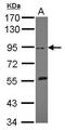 Discoidin Domain Receptor Tyrosine Kinase 2 antibody, PA5-27730, Invitrogen Antibodies, Western Blot image 