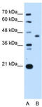 CMP-N-acetylneuraminate-beta-galactosamide-alpha-2,3-sialyltransferase 4 antibody, TA339036, Origene, Western Blot image 