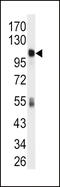 10-FTHFDH antibody, 63-241, ProSci, Western Blot image 