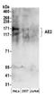 AE 2 antibody, A304-503A, Bethyl Labs, Western Blot image 