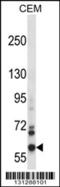 NADPH oxidase 5 antibody, 57-386, ProSci, Western Blot image 