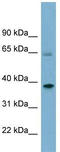 Sorting Nexin 7 antibody, TA345085, Origene, Western Blot image 