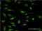 Ring Finger Protein 2 antibody, H00006045-M08, Novus Biologicals, Immunocytochemistry image 