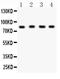 X-Ray Repair Cross Complementing 5 antibody, PB9464, Boster Biological Technology, Western Blot image 