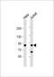 Phosphofructokinase, Platelet antibody, 63-416, ProSci, Western Blot image 
