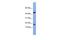 LSM1 Homolog, MRNA Degradation Associated antibody, GTX47320, GeneTex, Western Blot image 
