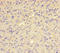 QC antibody, LS-C317668, Lifespan Biosciences, Immunohistochemistry paraffin image 