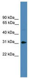 Amphiregulin antibody, TA329139, Origene, Western Blot image 