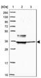 Spermatogenesis Associated Serine Rich 1 antibody, NBP2-31037, Novus Biologicals, Western Blot image 