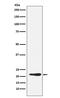 Growth Differentiation Factor 3 antibody, M06869, Boster Biological Technology, Western Blot image 