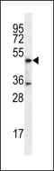 DSN1 Component Of MIS12 Kinetochore Complex antibody, LS-C167545, Lifespan Biosciences, Western Blot image 