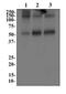 Solute Carrier Family 1 Member 3 antibody, GTX20262, GeneTex, Western Blot image 