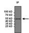 Paired Box 6 antibody, GTX79189, GeneTex, Immunoprecipitation image 