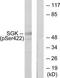 SGK antibody, TA314531, Origene, Western Blot image 